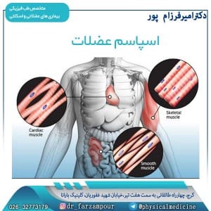 اسپاسم عضلات - دکتر امیر فرزام پور