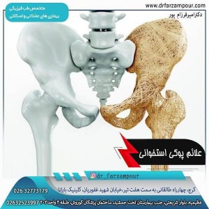 پوکی استخوان - دکتر فرزام پور