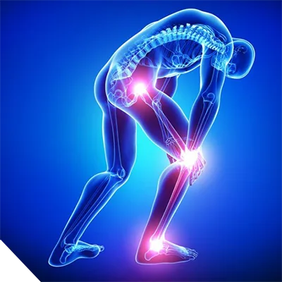 درمان آرتروز مفاصـل