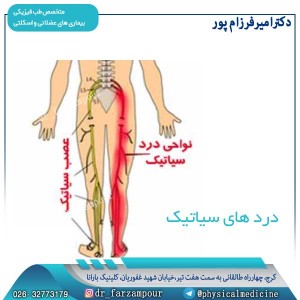 دردهای سیاتیک - دکتر فرزام پور