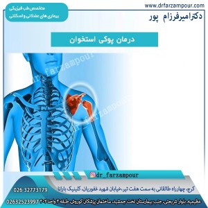 درمان پوکی استخوان - دکتر فرزام پور