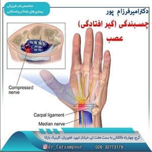 درمان چسبندگی عصب دست 2