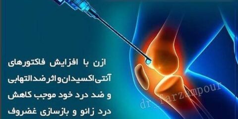 ازن تراپی و آرتروز