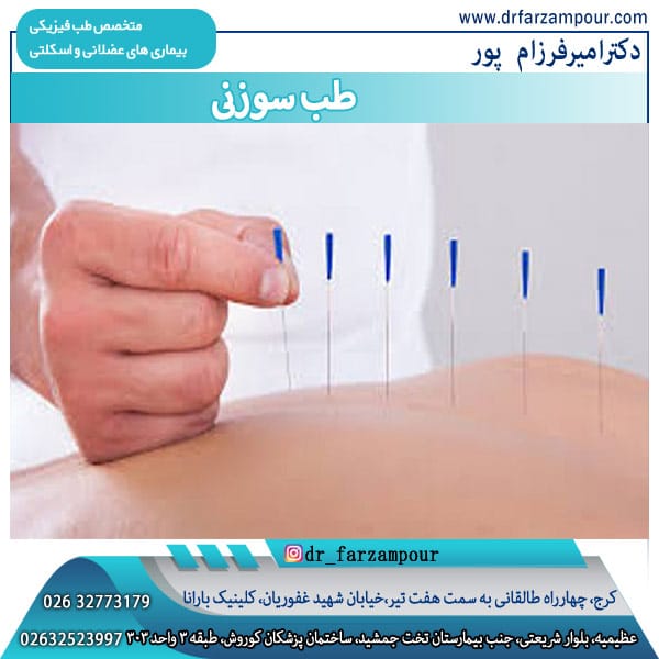طب سوزنی در کرج 