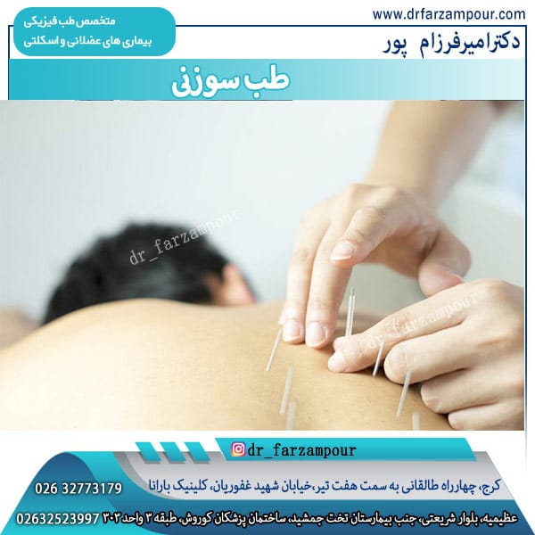 طب سوزنی در کرج دکتر فرزام پور