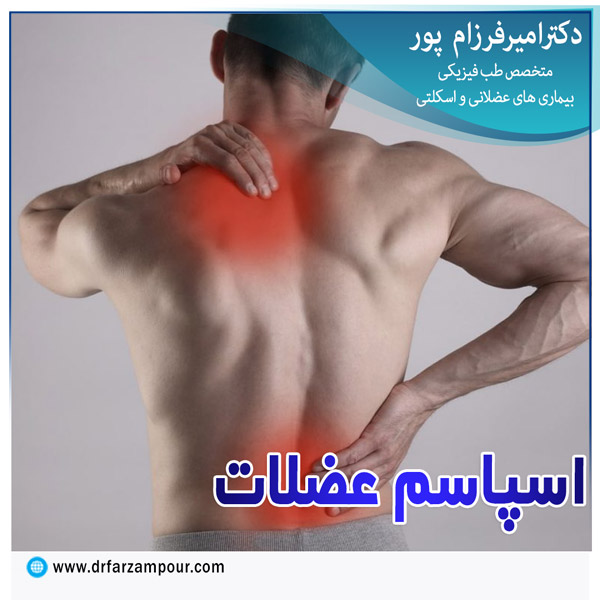 اسپاسم عضلات - دکتر فرزام پور