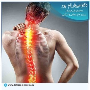درمان دیسک گردن - دکتر فرزام پور