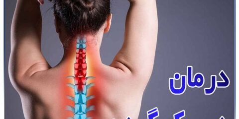 درمان دیسک گردن + دکتر فرزام پور