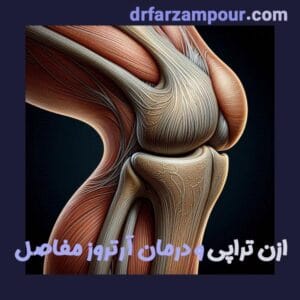 Ozone therapy and arthritis treatment
