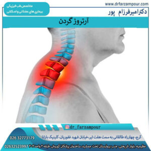 آرتروز گردن | دکتر امیر فرزام پور