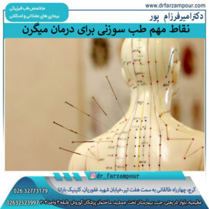 نقاط مهم و حساس عصب ها در درمان میگرن