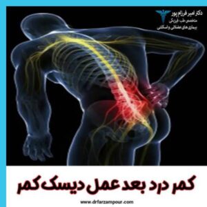 کمر درد بعد عمل دیسک کمر - دکتر امیر فرزام پور