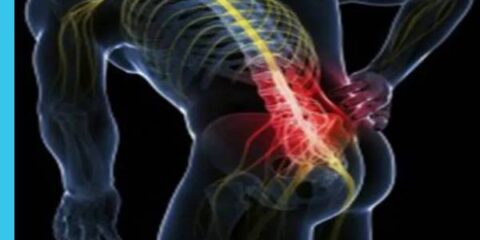 کمر درد بعد عمل دیسک کمر - دکتر امیر فرزام پور