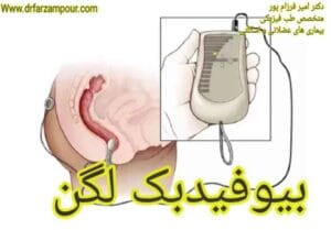 بیوفیدبک لگن - دکتر امیر فرزام پور