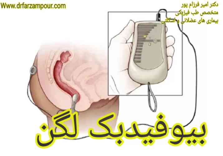 بیوفیدبک لگن - دکتر امیر فرزام پور