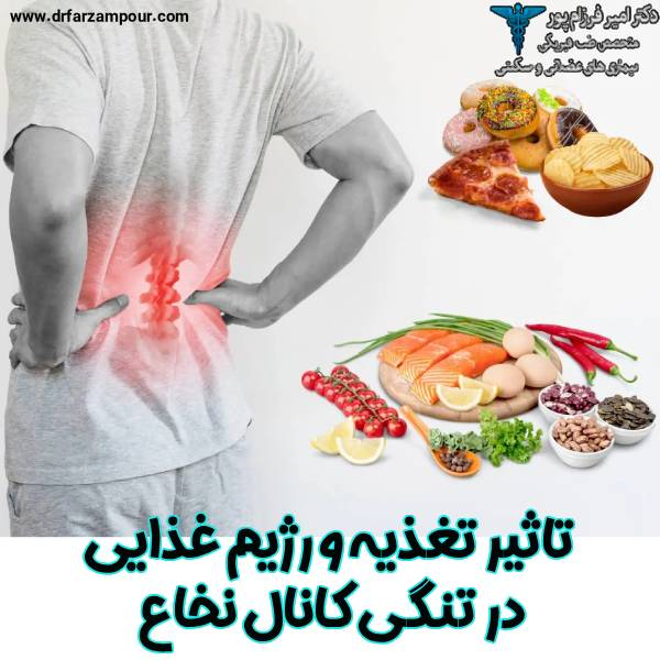 تاثیر تغذیه و رژیم غذایی در تنگی کانال نخاع - دکتر امیر فرزام پور