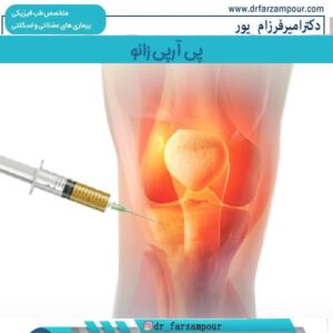 پی آر پی زانو